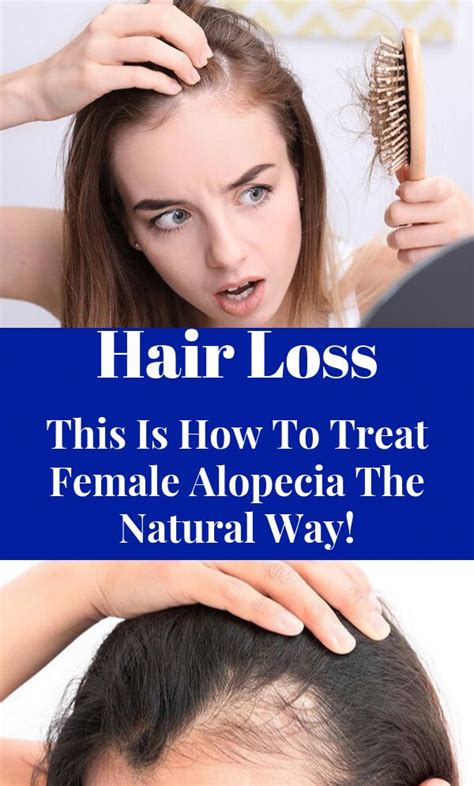 7 ways to stop hair loss in its tracks. Hair Loss - This Is How To Treat Female Alopecia The ...