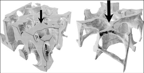 Biomechanics of Musculoskeletal Injury | IntechOpen