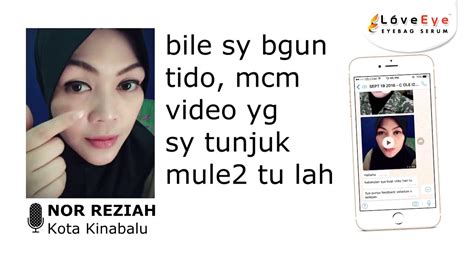hilangkan eyebag & lingkaran gelap dengan loveeye eyebag ...