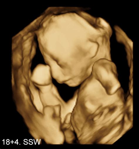 Ssw (16 4) es ist sogar ein kurzes stück mit 3d ultraschall dabei! Babykino 3D / 4D Ultraschall