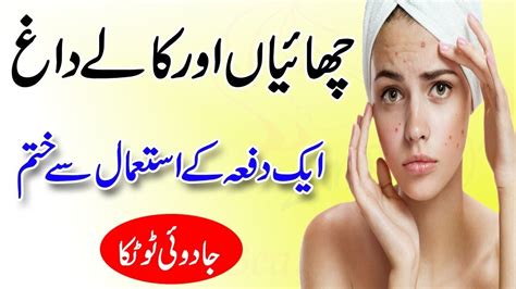 So take a look at home. How to remove dark spot on face naturally in Urdu||Beauty ...