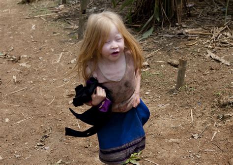 Find more similar words at wordhippo.com! Hmong albino girl - Laos | I even this little albino girl ...