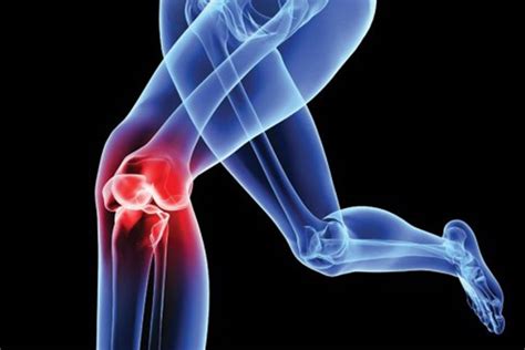 Ginocchio: la sindrome Femoro-Rotulea - Studio di Fisioterapia