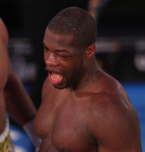 Join facebook to connect with daniel dubois and others you may know. Daniel Dubois saved his sight and career by taking knee ...
