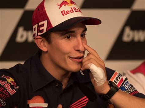 Bagaimana buat marc marquez sendiri? Marc Marquez Verletzung: Ein Freund fuhr ihm über die Hand