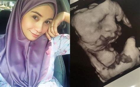 Izreen azminda pictures and photos. "Baru 33 Minggu Dah Dekat 3 Kg" - Izreen Azminda Tak Sabar ...