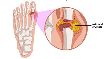 Research suggests that dogs can detect many types of cancers in humans. What Is Bone Marrow Cancer? What Causes Bone Marrow Cancer