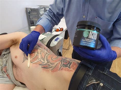 When it comes to laser tattoo removal during pregnancy or breastfeeding, we recommend speaking with your gp, and in all cases we will follow their advice. Best Aftercare post Laser Tattoo Removal - LaserYou ...