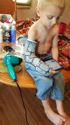 Pimp studio is home to the amateur teen. decorating arm cast ideas - Google Search | bows for 5 ...