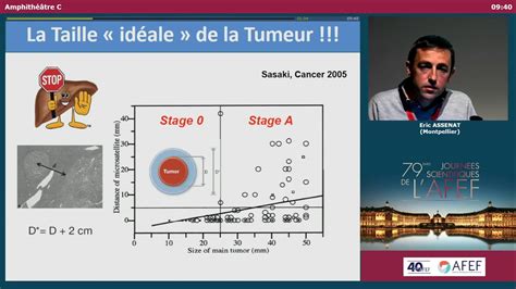 Traitement modifier le code. Traitement curatif non chirurgical du CHC - E. ASSENAT ...