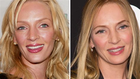 Why Does Uma Thurman Look So Different? - Revival By Stacy