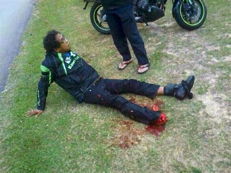 Lukisan gambar kereta api kereta api saya gambar dalam versi mesin uap dengan asap yang keluar dari corong lokomotifnya. Ngeri! 3 Gambar Pergelangan Kaki Rider Hancur Kemalangan ...