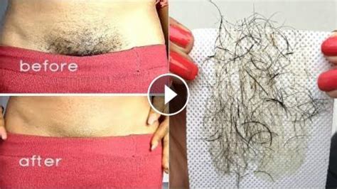 Best ways to remove pubic hair. Remove Pubic Hair at Home Naturally & Permanently | No ...