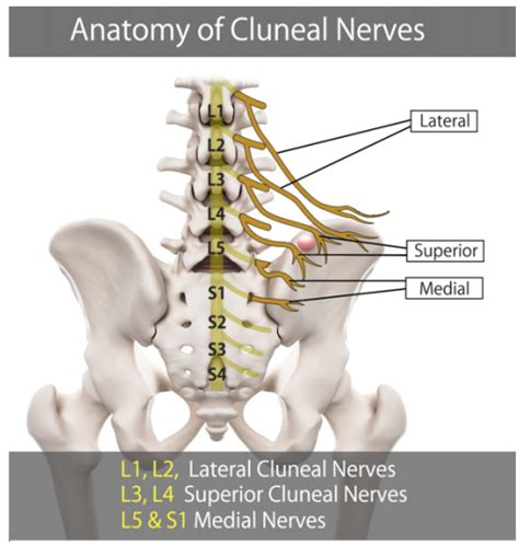 The sural nerve is rather superficial, which makes it more accessible to surgeons. Cluneal Nerve Pain - WikiMSK