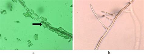 Mycelia of C. gloeosporioides (a) treated with ALE, (b) treated with... | Download Scientific ...