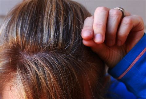 Plenty of whole grain breads and cereals which contain lots of wheat germ and bran for brown. 10 Surprising Natural Remedies For Grey Hair Finally Revealed