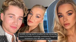 Abbie quinnen reveals 'horrible' instagram abuse over burns. WATCH: Amber Rose Snogs Amy Schumer After An Awkward Encounter With Kendall Jenner - Capital