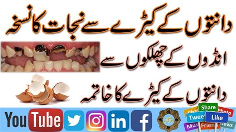 Pending pending follow request from @thairath_news. Treatment of Teeth problems | Danton ke keere se Nijat ka ...