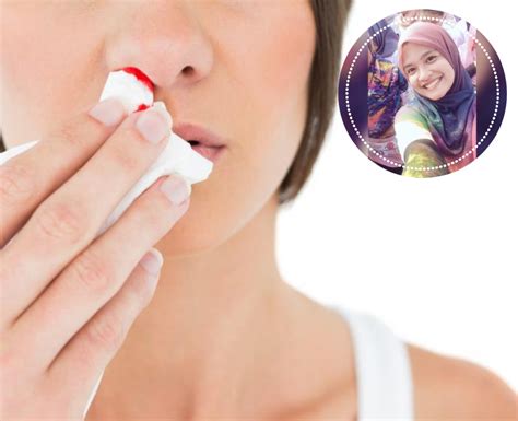 Oleh izzah nazirah october 1, 2020. Hidung Berdarah, Doktor Sarankan Lakukan Cara Ni Segera ...