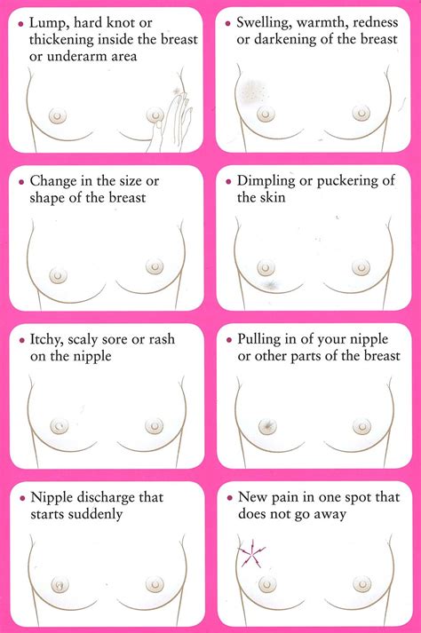 The most common symptom of breast cancer for 90% of women is a new lump or mass in their breast. 8 Warning Signs of Breast Cancer | Susan G. Komen® Puget Sound