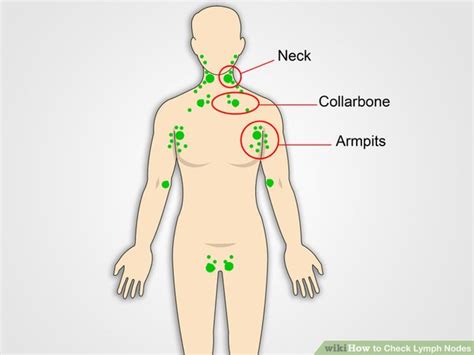 What are swollen lymph nodes? Armpit Lumps and Pain