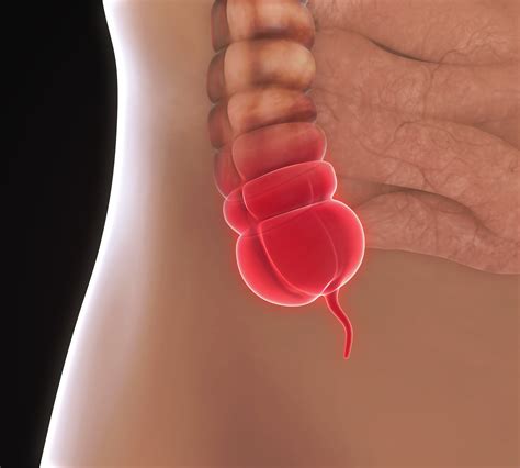 The pain normally starts near the navel the appendix pain can over time change, making the establishment of a diagnosis often difficult. How to Tell If That Pain Is Your Appendix - Health ...