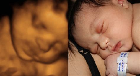 Menu & reservations make reservations. 3D ultrasound images - Sweet Baby O' Mine Ft. Myers, Florida