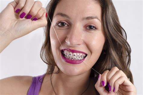 Once teeth are straightened by braces, it is easier to reach plaque on and between your teeth. How to Floss Your Teeth With Braces