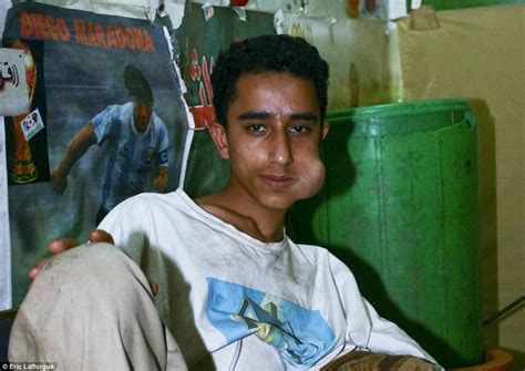 Users feel alert, relaxed and more talkative. The appalling fate of Yemen and Somalia's khat addicts ...