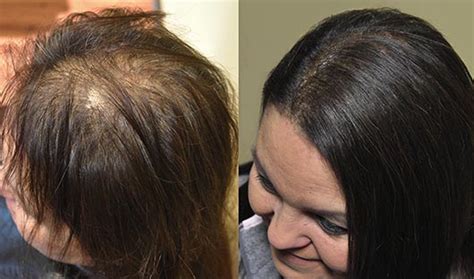 Di Biase Hair Extensions USA- Before and Afters