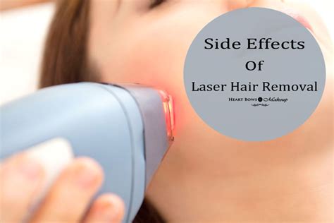 If you're thinking about having the treatment, it pays to know the facts so here's everything you need to know. Permanent Laser Hair Removal: Procedure, Side Effects ...