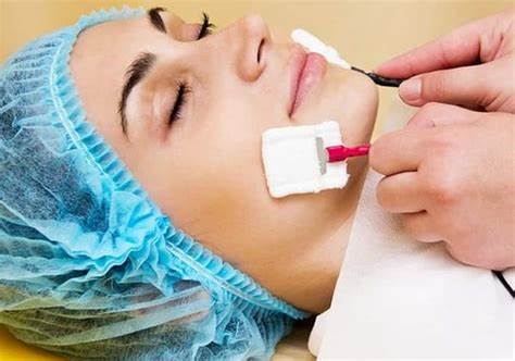 Диета при невралгии тройничного нерва Невралгия тройничного нерва: болезнь, влияющая на внешний вид | kvd9spb.ru Невралгия тройничного нерва: болезнь, влияющая на внешний вид | kvd9spb.ru Диета при невралгии тройничного нерва