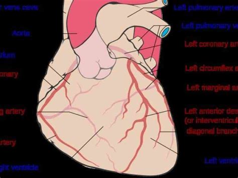 If you're wondering how to remove arterial plaque, you may be disappointed with the options. the Arteries Of The Heart Diagram heart receives its own ...