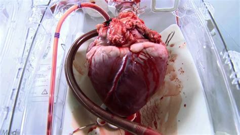 Make a rounded bump at the top of the heart for the right atrium. OCS™ Supports Heart - YouTube