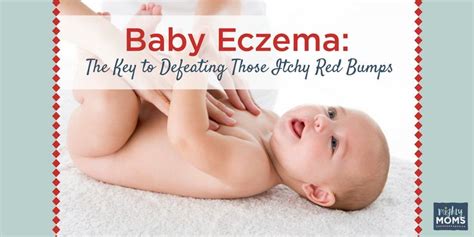 Some women would have a baby face by nature. Baby Eczema: The Key to Defeating Those Itchy Red Bumps (With images) | Baby eczema, Itchy red bumps
