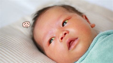 Ketentuan penjaminan bayi baru lahir. 4 Masalah Kulit yang Sering Terjadi pada Bayi Baru Lahir