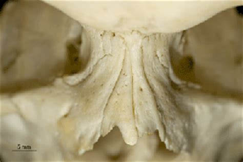 11th to 14th weeks of gestation. The Human Skull by Jessica Peterson