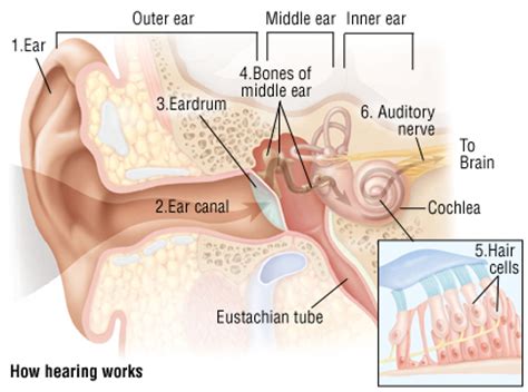 Ear infections, wax in the ear, hearing loss from loud noises, and meniere's disease. The Growing North American Epidemic of Hearing Loss ...