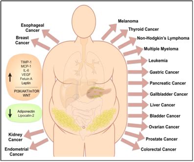 The association of obesity with cancer risks may be explained by the alterations in the metabolism of endogenous hormones, production of specific given that obesity is also associated with reduced survival for many cancers, the reduction of obesity is another primary target for cancer prevention. - MedCrave online