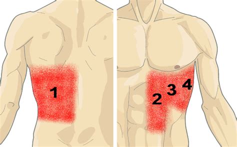 Ribs act like a cage of bones around your chest. Nguyên nhân tôi bị đau dưới xương sườn bên trái là gì ...