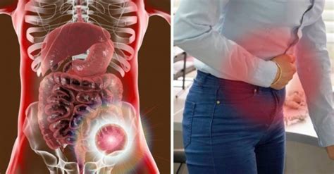 ⬇ descargue fotos de colon ✔ gran banco de imágenes de stock ▶ millones de fotos sin royalties de la mejor calidad a precios asequibles. Elimine el estreñimiento y limpie su colon con esta bebida ...