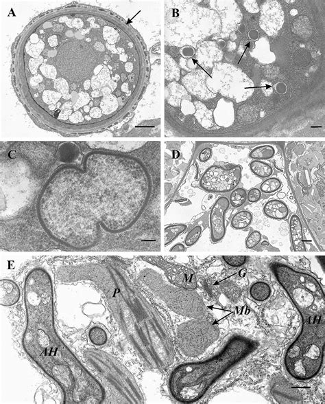 May 28, 2021 · les scientifiques ont confirmé le rôle du fameux gène en en privant un mutant d'une mousse, marchantia paleacea. American Journal of Botany