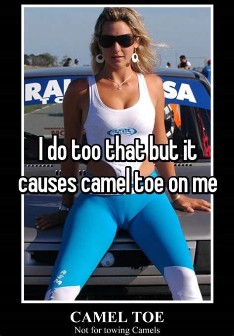 I guess a camel toe is also known as a front wedgy. I do too that but it causes camel toe on me