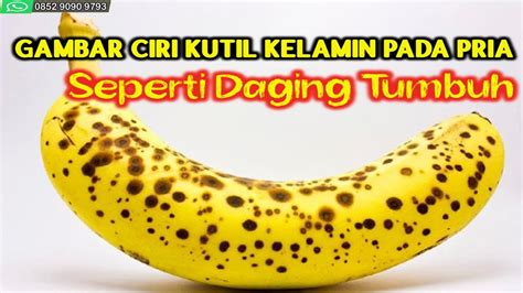 Terima kasih sudah melihat gambar dan foto foto buah maja rasanya pahit disclaimer: Gambar Ciri Kutil Kelamin Pada Pria Seperti Daging Tumbuh ...