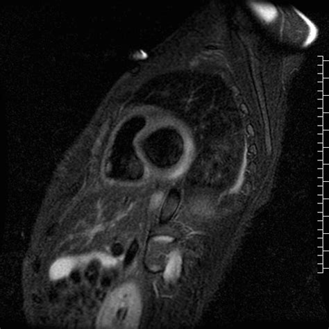 A ressonância magnética é um exame para diagnóstico por imagem que retrata imagens de alta definição dos órgãos através da utilização de campo magnético. Atria - Tomografia e Ressonância Cardíaca para o Clínico