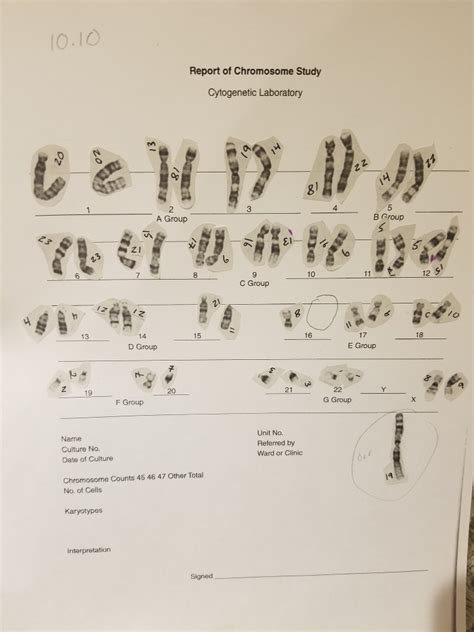 Human karyotyping answer key vocabulary: Student Exploration: Human Karyotyping - Human Kar Yo ...