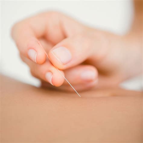 Akupunktur ile bağlantı kurmak için şimdi facebook'a katıl. Akupunktur - Hebamme Glattal