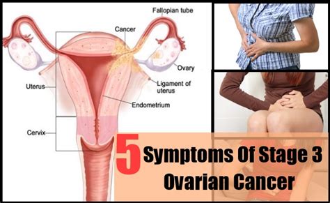 Easier and faster to get full at meals. 5 Major Symptoms Of Stage 3 Ovarian Cancer | Lady Care Health