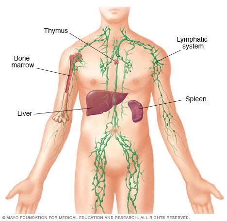 Symptoms of mesothelioma mayo clinic. Lymphedema - Symptoms and causes - Mayo Clinic | Lymphatic ...