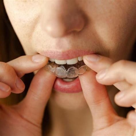 There's a dangerous trend going around of teenagers applying diy (do it yourself) braces to their own teeth as a means of fixing them!check us out on. DIY Dental Impression Kit | A Listly List